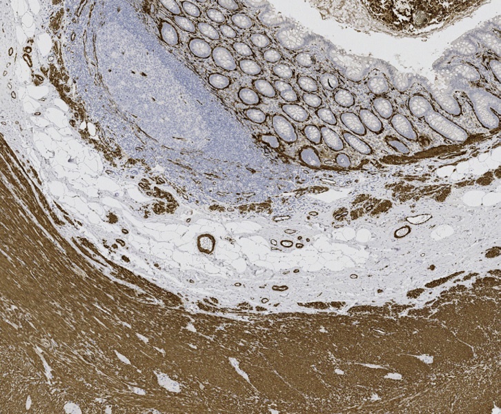 Tissue-Tek Genie<sup>®</sup><br /> anti-Actin, Smooth Muscle Tissue-Tek Genie<sup>®</sup><br /> anti-Actin, Smooth Muscle